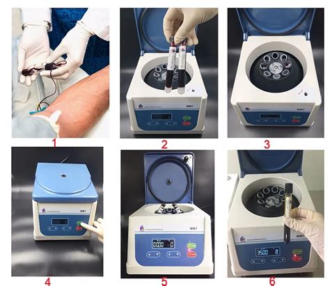 centrifuge machine for prp|prp centrifuge speed and time.